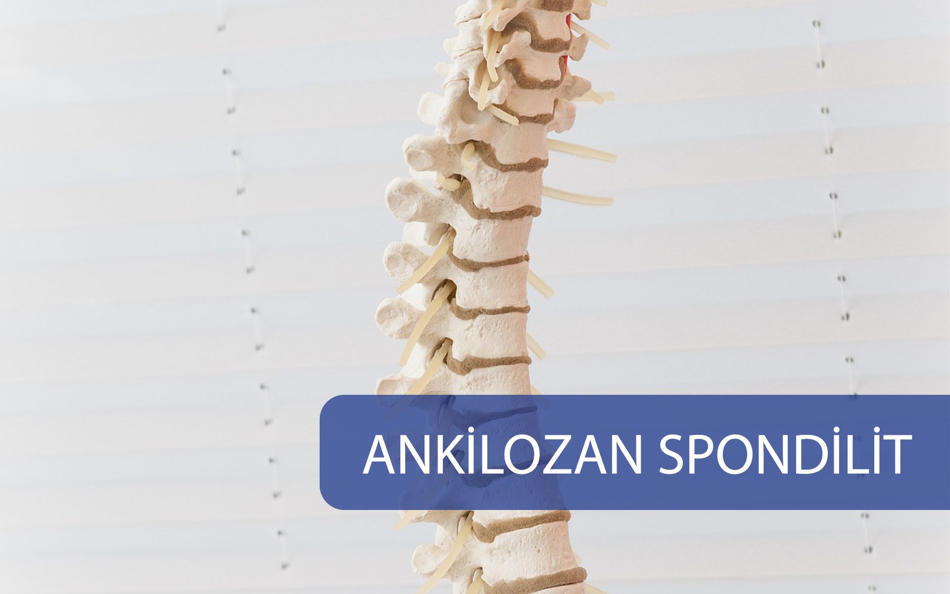 Ankilozan Spondilit
