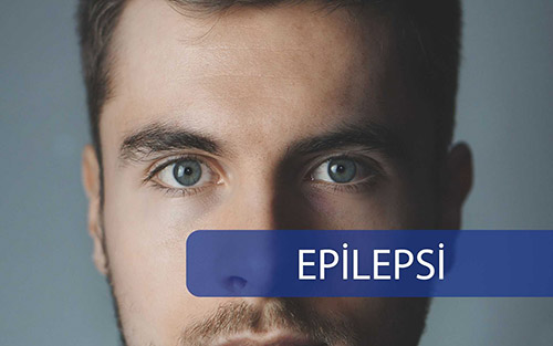 Epilepsi