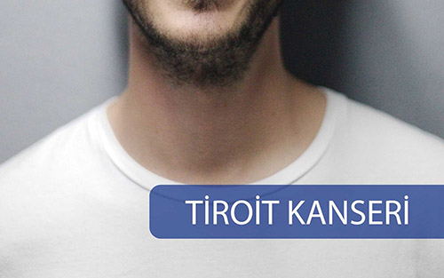 Tiroit Kanseri