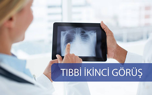 Tıbbi İkinci Görüş Nedir?