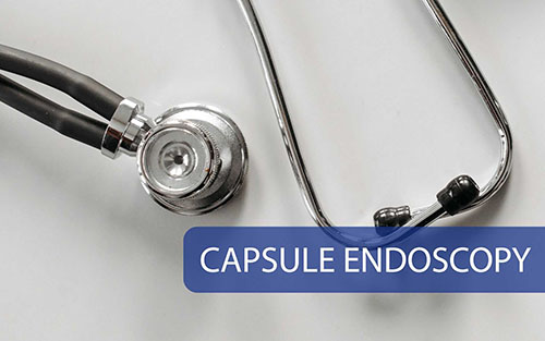Capsule Endoscopy