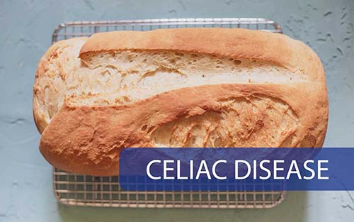 Celiac Disease