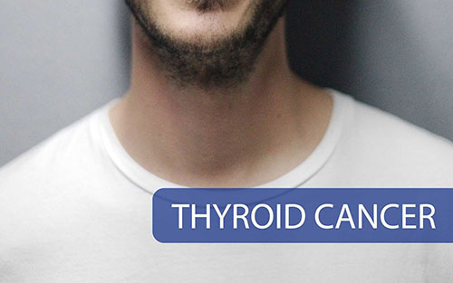 Thyroıd Cancer