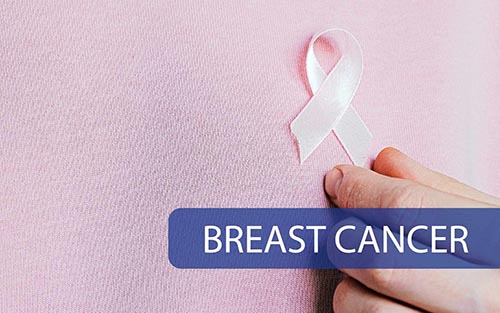 Breast Cancer