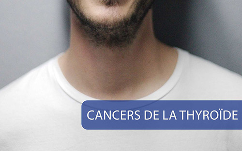 Cancer De La Thyroïde