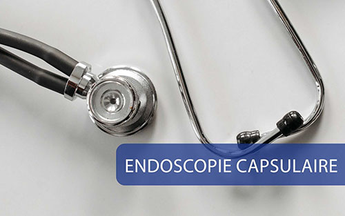 Endoscopie Capsularıe