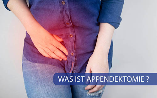 Appendektomie: Was ist das, wie wird sie durchgeführt, und wie verläuft der Heilungsprozess?
