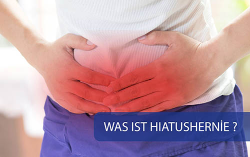 Hiatushernie: Was ist das, Symptome, Ursachen und Behandlungsmöglichkeiten
