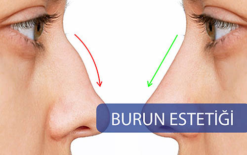 Rinoplasti & Septorinoplasti (Burun Estetiği)