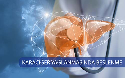 KARACİĞER YAĞLANMASINDA BESLENME ÖNERİLERİ