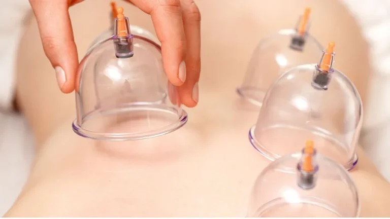 Hacamat Kimlere Yapılmaz?